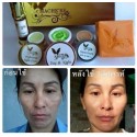 3X Mache're Gold Whitening Cream Acne freckles wrinkles Natural Premium skin