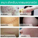 ELAIMEI Scar Skin Body Cream Stretch Marks Remover Acne removal 10X50ml
