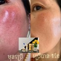 Miracle Dr.Tiara Face Treatment Set ( 5 Pieces )