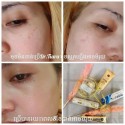 Miracle Dr.Tiara Face Treatment Set ( 5 Pieces )